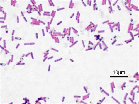 Bacillus Subtilis Wikidoc