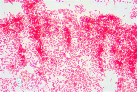 Gram Staining Gram Negative Bacilli Stock Photo Download Image Now