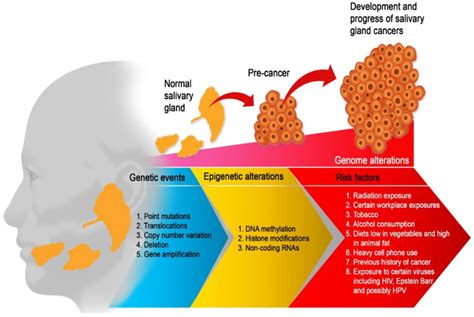 Cancers Free Full Text The Epigenesis Of Salivary Glands Carcinoma