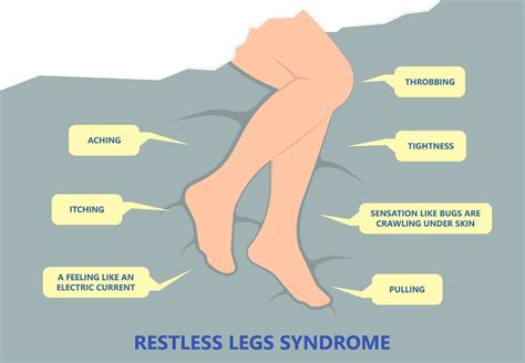 Restless Leg Syndrome Cibdol