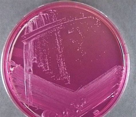 Staphylococcus Epidermidis On Mannitol Agar Medical Laboratories