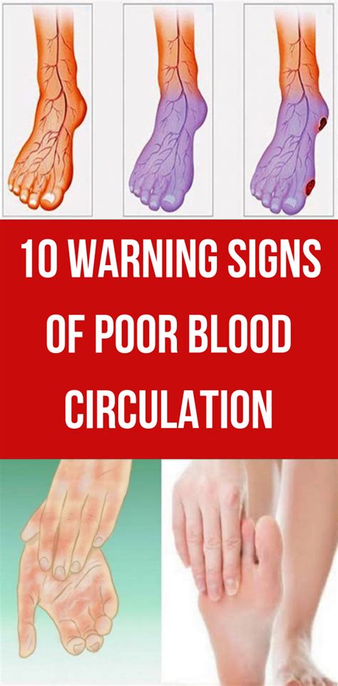 Herbal Medicine 10 Warning Signs Of Poor Blood Circulation