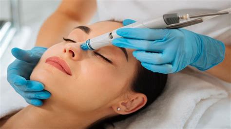 What Are Hydrafacials And Why Are They So Popular