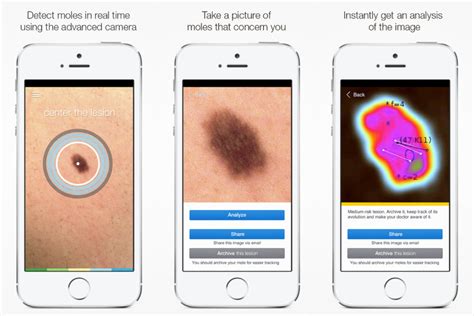 Mhealth For Skin Cancer Prevention And Detection Elinext
