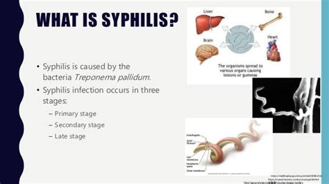 Microbiology Syphilis
