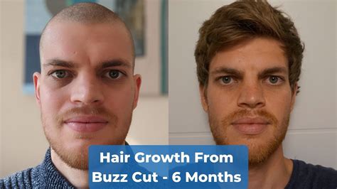 Hair Growth Time Lapse 6 Months From Buzz Cut Youtube