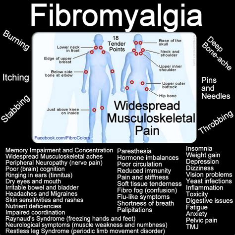 Fibromyalgia Illness Diagnose Health Fibromyalgia How To Diagnose