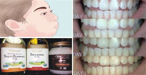 How Oil Pulling Can Whiten Your Teeth Improve Your Gums And Transform
