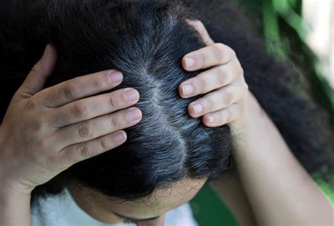 Premature Graying Of Hair Possible Causes And Treatments