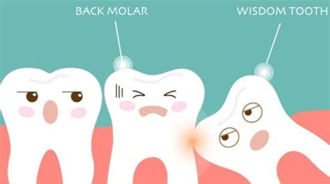 Learn The Basics About Wisdom Teeth