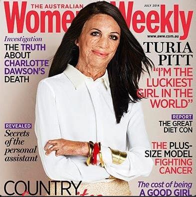 Burn Victim Turia Pitt Latest Cover Model For Australian Women S Weekly Has Burns On Of