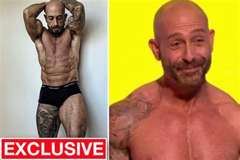 Naked Attraction Star Debuts Painful Op Results As Daddy Moniker Pushed Him To Surgery Daily