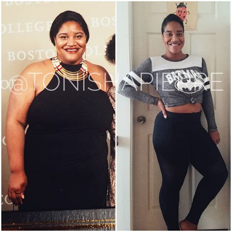 15 Captivating Weight Loss Surgery Before And After Sleeve Best