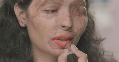 Acid Attack Victim Tells Women About Her Horrific Ordeal While Sharing Make Up Tips World News