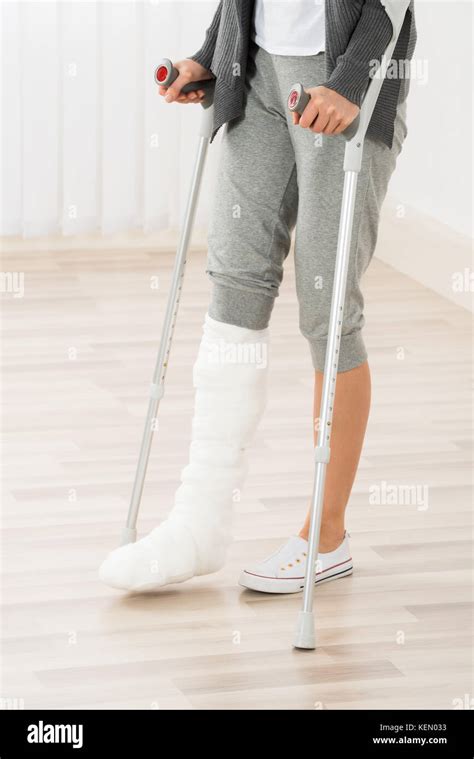 Close Up Of Woman Leg In Plaster Cast Using Crutches While Walking