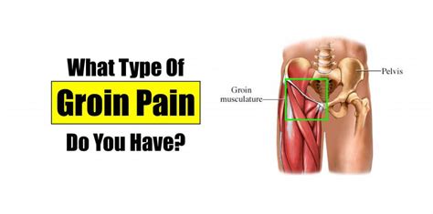 What is a groin strain? Groin Pain - HealthnPhysio