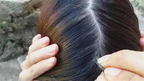 Pluck White Hair That Makes Itching On The Head Youtube