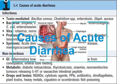 Causes of Acute Diarrhea - Medical eStudy