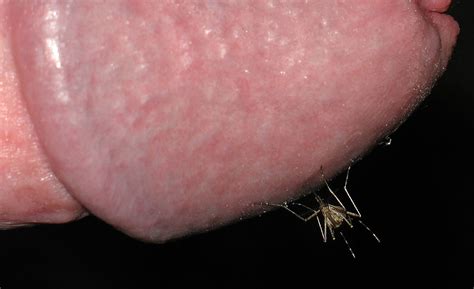 Mosquito Penis Torture