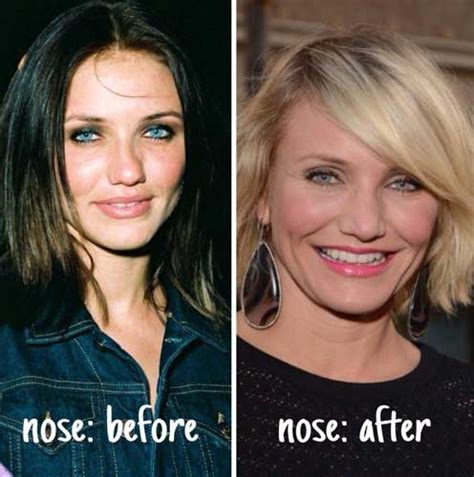 Cameron Diaz Plastic Surgery Nose Job Botox Boob Job