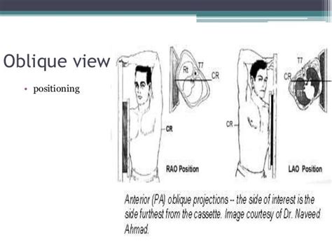 Chest X Ray Positioning