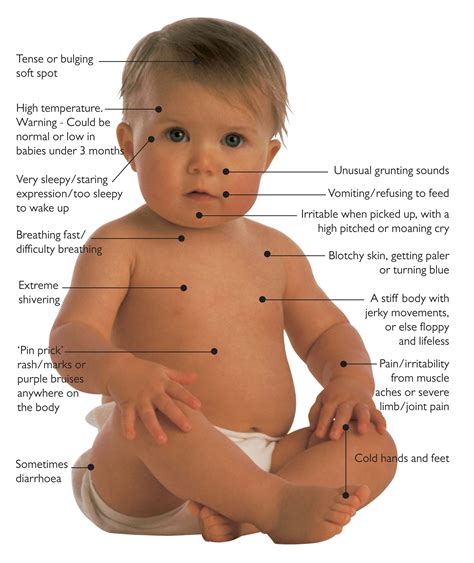 Common Diseases In Newborns Or Infants Pediatrician And Childcare