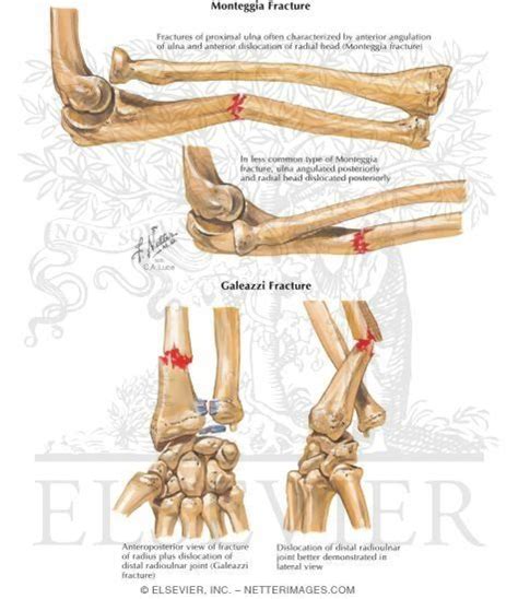 Trauma Hand Anatomy Sports Medicine Anatomy And Physiology