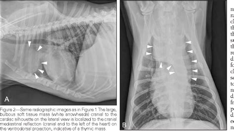 Figure 2 From What Is Your Diagnosis Thymoma Thymic Lymphoma Or