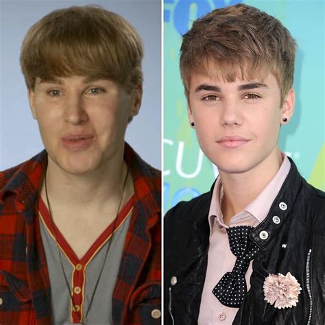 justin bieber fan plastic surgery before and after