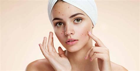 Coping With Acne The Treatments You May Not Have Considered