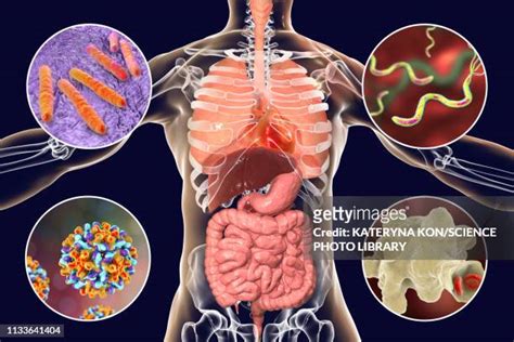 Amoebiasis High Res Illustrations Getty Images