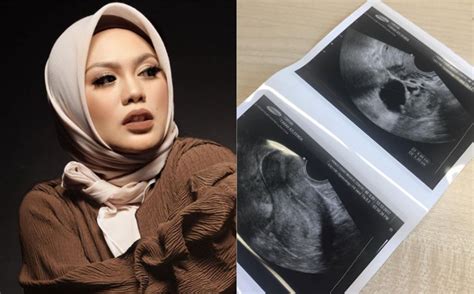 Akhirnya, confirm 100% jantina baby lepas buat scan 3d4d. 'Ini bukan 'baby scan' - keluhan Zulin Aziz hidap ...