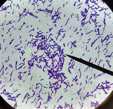 Its worth mentioning what the gram stain color means. Bacillus. Large gram positive rod-shaped bacteria.