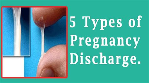 Discharge During Pregnancy Types Of Pregnancy Discharge Youtube