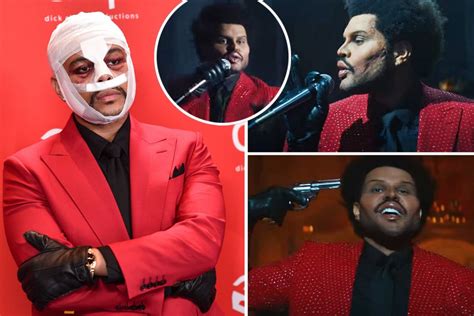 The Weeknd Shows Off Freaky Face From Plastic Surgery In New Music