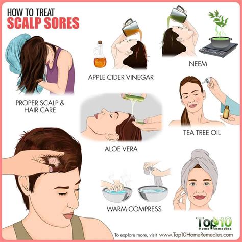 How To Treat Scalp Sores Top 10 Home Remedies Sores On Scalp Itchy