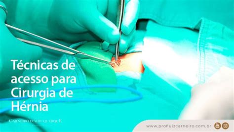 Técnicas De Acesso Para Cirurgia De Hérnia Prof Dr Luiz Carneiro