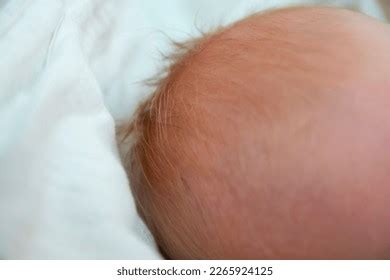 Newborn Baby Lanugo First Pubic Hair Stock Photo Shutterstock
