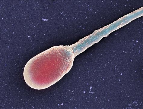 Human Sperm Cell Sem Photograph By Steve Gschmeissner Pixels