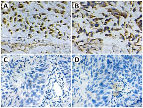 Representative Immunohistochemical Staining Of P16 And Pd L1