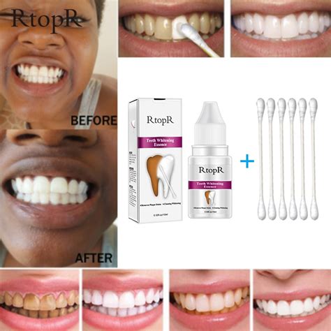 Rtopr Teeth Whitening Essence Powder Oral Hygiene Cleaning Serum