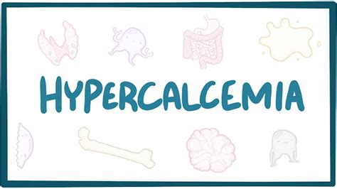 Hypercalcemia Treatment A Comprehensive Overview Of Treatment Options