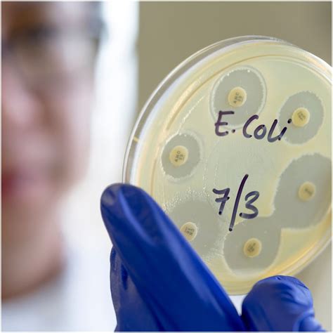 Interesting Facts About E Coli Health Guide Net