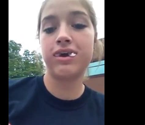Is This The Best Post Oral Surgery Video Ever