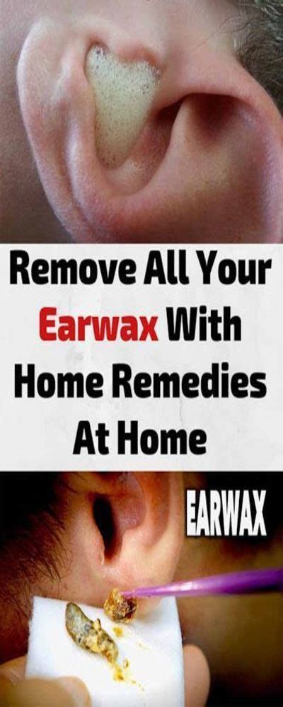 It has antiseptic properties, so it cleans the wound and prevents infection when used for cuts and scrapes. HOW TO USE HYDROGEN PEROXIDE TO REMOVE EAR WAX in 2020 ...
