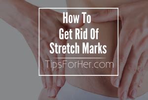 Naturally Get Rid Of Stretch Marks