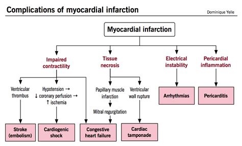 Rivaroxaban and risk of myocardial infarction: Complications of myocardial infarction | Pathophysiology ...