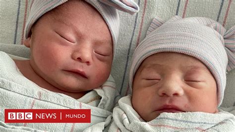 The Unusual Case Of Twins Who Were Born In Different Years In