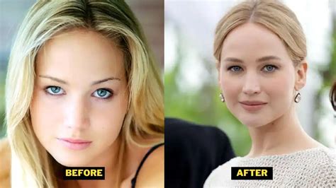 Jennifer Lawrence S Transformation Pre Veneer Teeth Weight Loss And Before After Photos