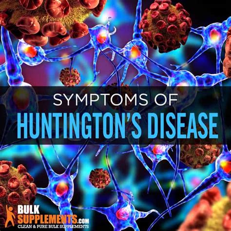 Huntingtons Disease Treatment Archives